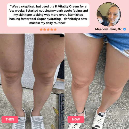 Anti-Cellulite Massager