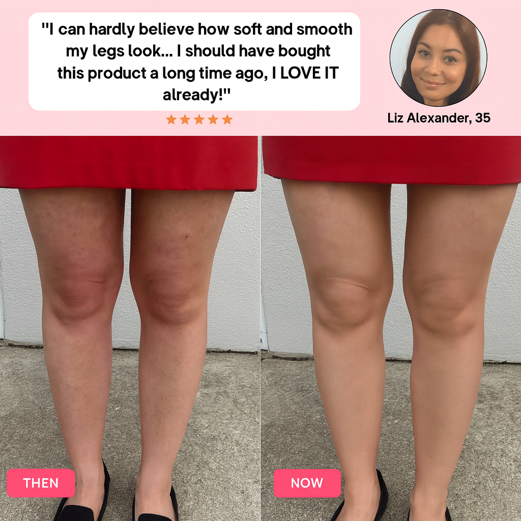 Anti-Cellulite Massager