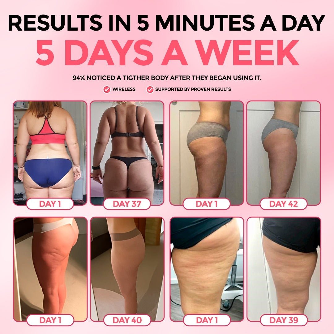 Anti-Cellulite Massager