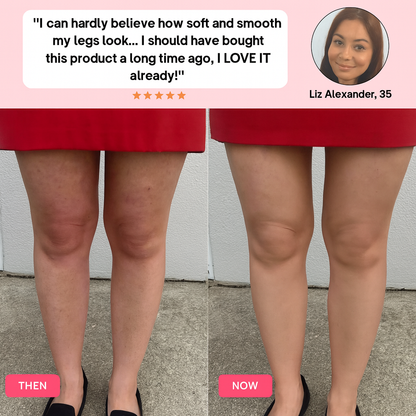 Anti-Cellulite Massager