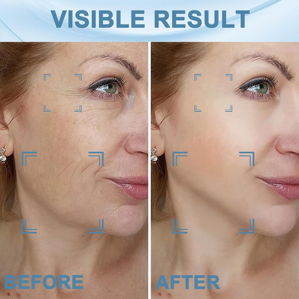 GlowLift Facial Therapy Device